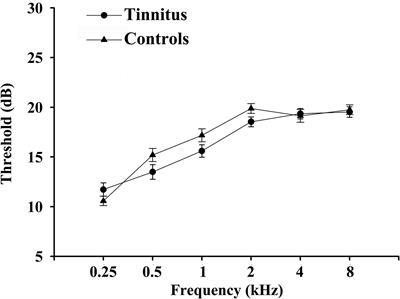 Glucose Control Has an Impact on Cerebral Blood Flow Alterations in Chronic Tinnitus Patients